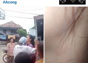 Remaja Jadi Korban Pengeroyokan di Pagar Dewa