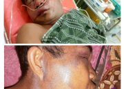 Desak Kapolsek Minas,! Beberapa Pelaku Penganiayaan/Pengeroyokan Ohi Jisekhi Bu,ulolo Belum Ditangkap dan Warung TuakNya Belum Ditutup, Ada Apa?